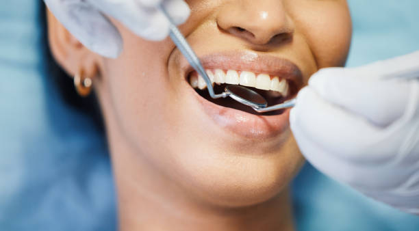 Best Emergency Tooth Extraction  in Spanay, WA