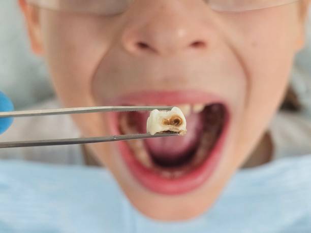 Best Tooth Pain Emergency Relief  in Spanay, WA